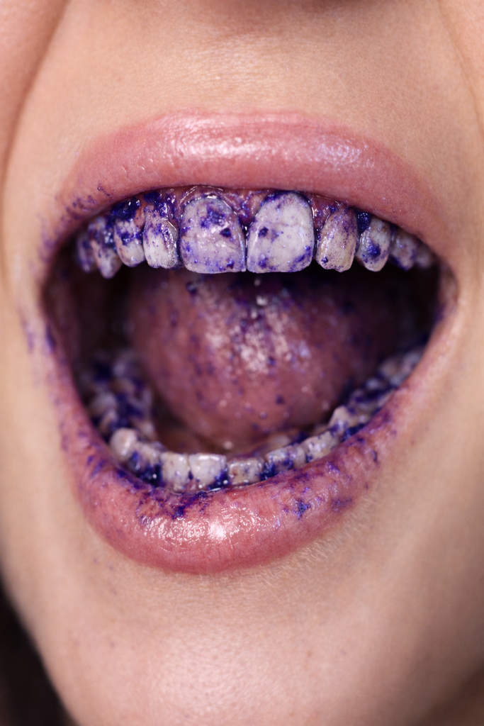 Bandes de blanchiment dentaire : résidus, sécurité et conseils de nettoyage