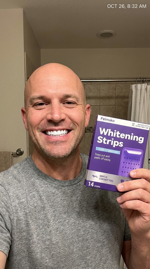 Kit blanchiment dentaire : lequel choisir ?