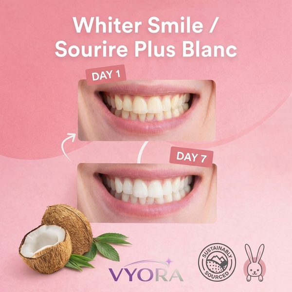 Vyora résultats blanchiment jour 1 et jour 7 - Vyora teeth whitening results day 1 and day 7